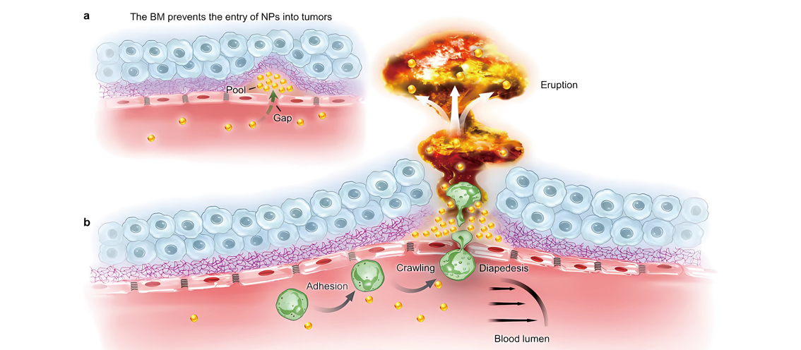 Enlisting Immune Cells to Breach the Basement Membrane Barrier of Tumor