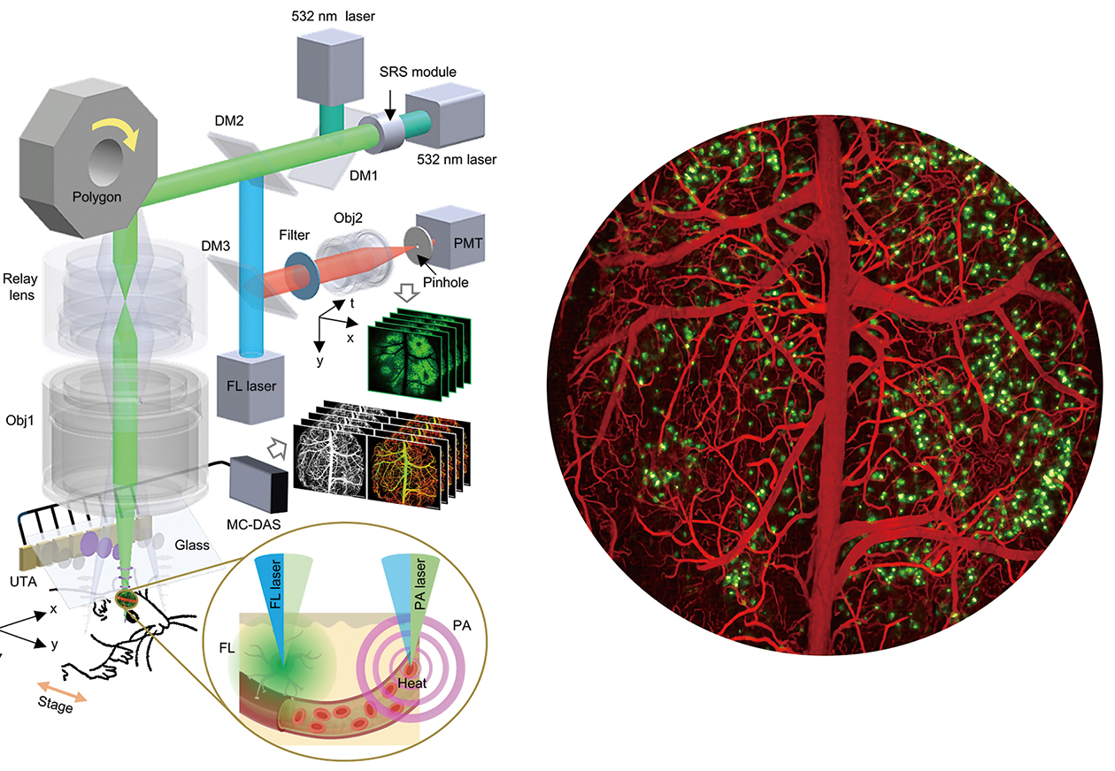 <p>Seeing the Whole Brain at Work</p>