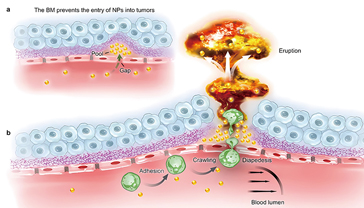 Enlisting Immune Cells to Breach the Basement Membrane Barrier of Tumor